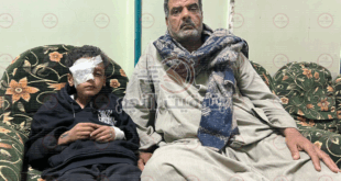 الطفل عمر ياسر محمد