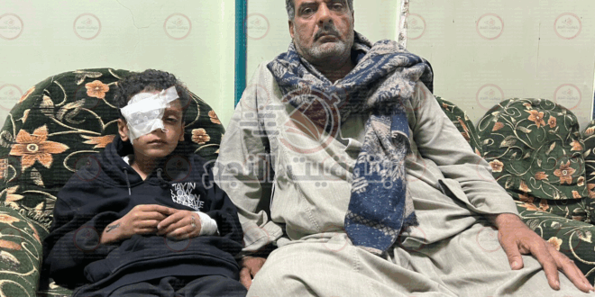 الطفل عمر ياسر محمد