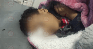 الطفل المصاب