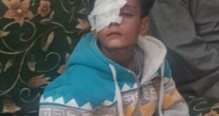 الطفل المصاب