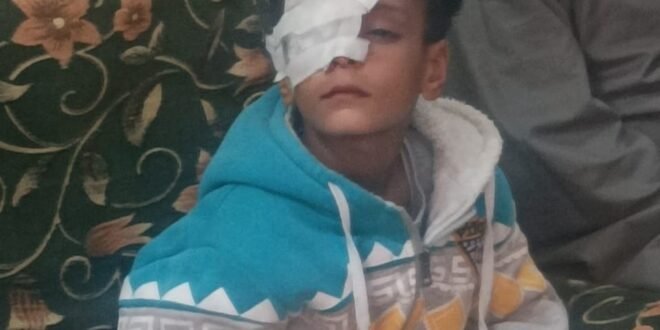 الطفل المصاب