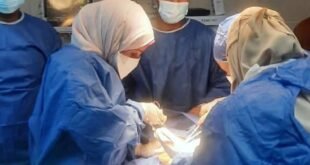 أثناء العملية