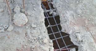 عملية الإزالة