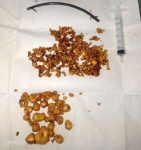 مستشفى قنا العام