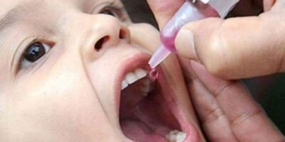 شلل الأطفال