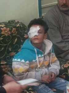 الطفل المصاب
